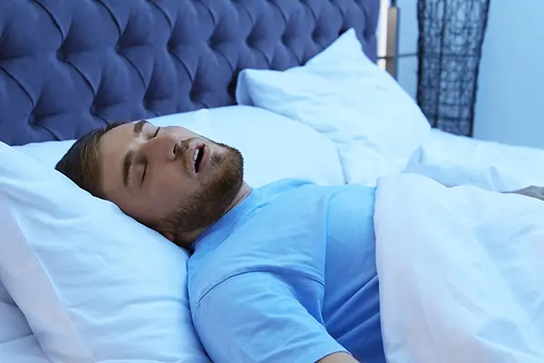 Man with sleep apnea snoring while trying to sleep in bed 