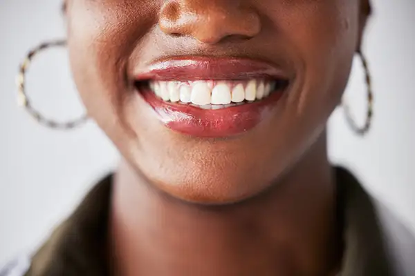 A close-up of a woman's bright and healthy smile, emphasizing straight white teeth and oral hygiene.