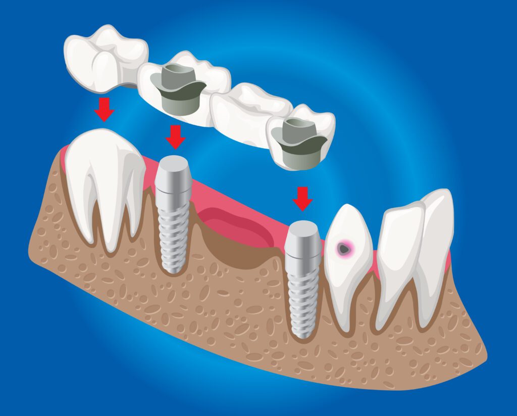 Isometric Prosthetic Dentistry Concept
